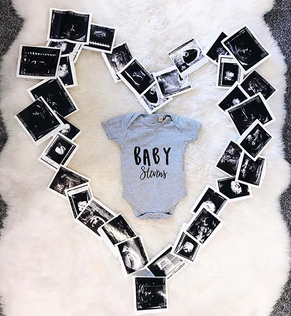 Ανακοίνωση εγκυμοσύνης Baby Scan and Onesie